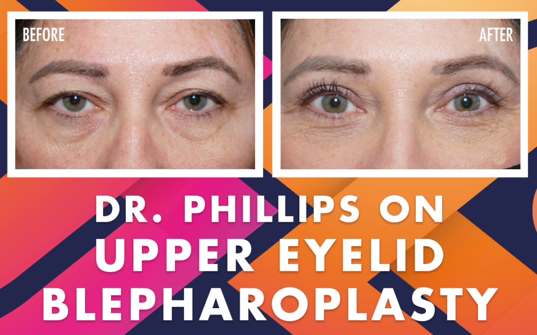 Upper Eyelid Blepharoplasty